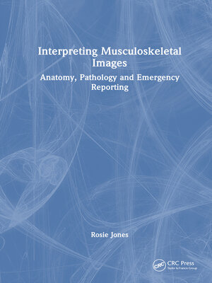 cover image of Interpreting Musculoskeletal Images